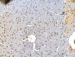 ADCY10 Antibody in Immunohistochemistry (Paraffin) (IHC (P))