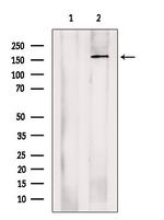 ADCY10 Antibody in Western Blot (WB)