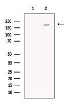 ADCY10 Antibody in Western Blot (WB)