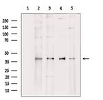 Aldolase Antibody in Western Blot (WB)