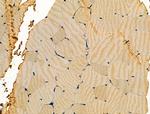 Aldolase Antibody in Immunohistochemistry (Paraffin) (IHC (P))