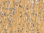 Aldolase Antibody in Immunohistochemistry (Paraffin) (IHC (P))