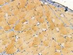 Aldolase Antibody in Immunohistochemistry (Paraffin) (IHC (P))