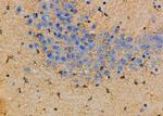 Aldolase C Antibody in Immunohistochemistry (Paraffin) (IHC (P))