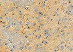 Aldolase C Antibody in Immunohistochemistry (Paraffin) (IHC (P))