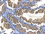 Spectrin alpha-1 Antibody in Immunohistochemistry (Paraffin) (IHC (P))