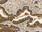 Angiopoietin 1 Antibody in Immunohistochemistry (Paraffin) (IHC (P))