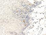 Anillin Antibody in Immunohistochemistry (Paraffin) (IHC (P))