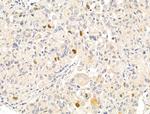 Anillin Antibody in Immunohistochemistry (Paraffin) (IHC (P))