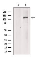 Anillin Antibody in Western Blot (WB)