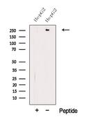 Apolipoprotein B Antibody in Western Blot (WB)