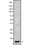 ApoC3 Antibody in Western Blot (WB)