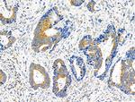 APPL1 Antibody in Immunohistochemistry (Paraffin) (IHC (P))