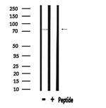 APPL1 Antibody in Western Blot (WB)