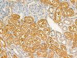 ARF1/ARF3/ARF5/ARF6 Antibody in Immunohistochemistry (Paraffin) (IHC (P))