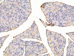 Asporin Antibody in Immunohistochemistry (Paraffin) (IHC (P))