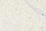 ATF6 Antibody in Immunohistochemistry (Paraffin) (IHC (P))