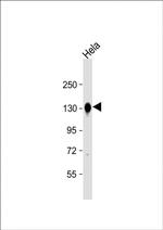 M-cadherin Antibody in Western Blot (WB)