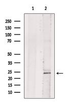 BASP1 Antibody in Western Blot (WB)