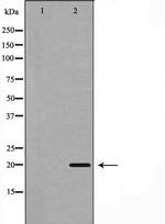 PUMA alpha Antibody in Western Blot (WB)