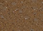 BCL11A Antibody in Immunohistochemistry (Paraffin) (IHC (P))