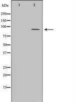 BCL11A Antibody in Western Blot (WB)