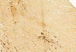 BCL-2 Antibody in Immunohistochemistry (Paraffin) (IHC (P))