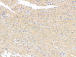 Tubulin beta-2C Antibody in Immunohistochemistry (Paraffin) (IHC (P))