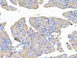 Tubulin beta-2C Antibody in Immunohistochemistry (Paraffin) (IHC (P))