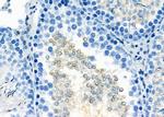 IBSP Antibody in Immunohistochemistry (Paraffin) (IHC (P))