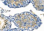 IBSP Antibody in Immunohistochemistry (Paraffin) (IHC (P))