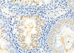 IBSP Antibody in Immunohistochemistry (Paraffin) (IHC (P))