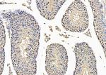 Brachyury Antibody in Immunohistochemistry (Paraffin) (IHC (P))