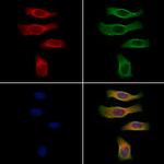 CGRP Antibody in Immunocytochemistry (ICC/IF)