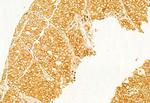 Calnexin Antibody in Immunohistochemistry (Paraffin) (IHC (P))