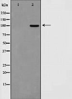 Calnexin Antibody in Western Blot (WB)