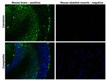 Calretinin Antibody in Immunohistochemistry (Paraffin) (IHC (P))