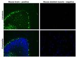 Calretinin Antibody in Immunohistochemistry (Paraffin) (IHC (P))