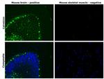 Calretinin Antibody