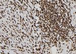 Calretinin Antibody in Immunohistochemistry (Paraffin) (IHC (P))