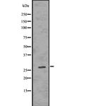 Calretinin Antibody in Western Blot (WB)