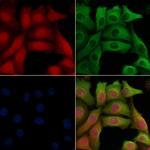 KChIP3 Antibody in Immunocytochemistry (ICC/IF)