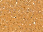 KChIP3 Antibody in Immunohistochemistry (Paraffin) (IHC (P))