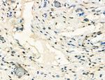 HP1 beta Antibody in Immunohistochemistry (Paraffin) (IHC (P))