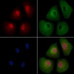 CBX4 Antibody in Immunocytochemistry (ICC/IF)