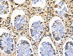 CBX4 Antibody in Immunohistochemistry (Paraffin) (IHC (P))