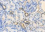 TARC Antibody in Immunohistochemistry (Paraffin) (IHC (P))