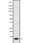 TARC Antibody in Western Blot (WB)