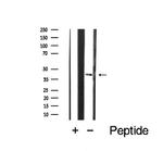 CCR5 Antibody in Western Blot (WB)