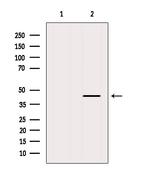 CCR5 Antibody in Western Blot (WB)